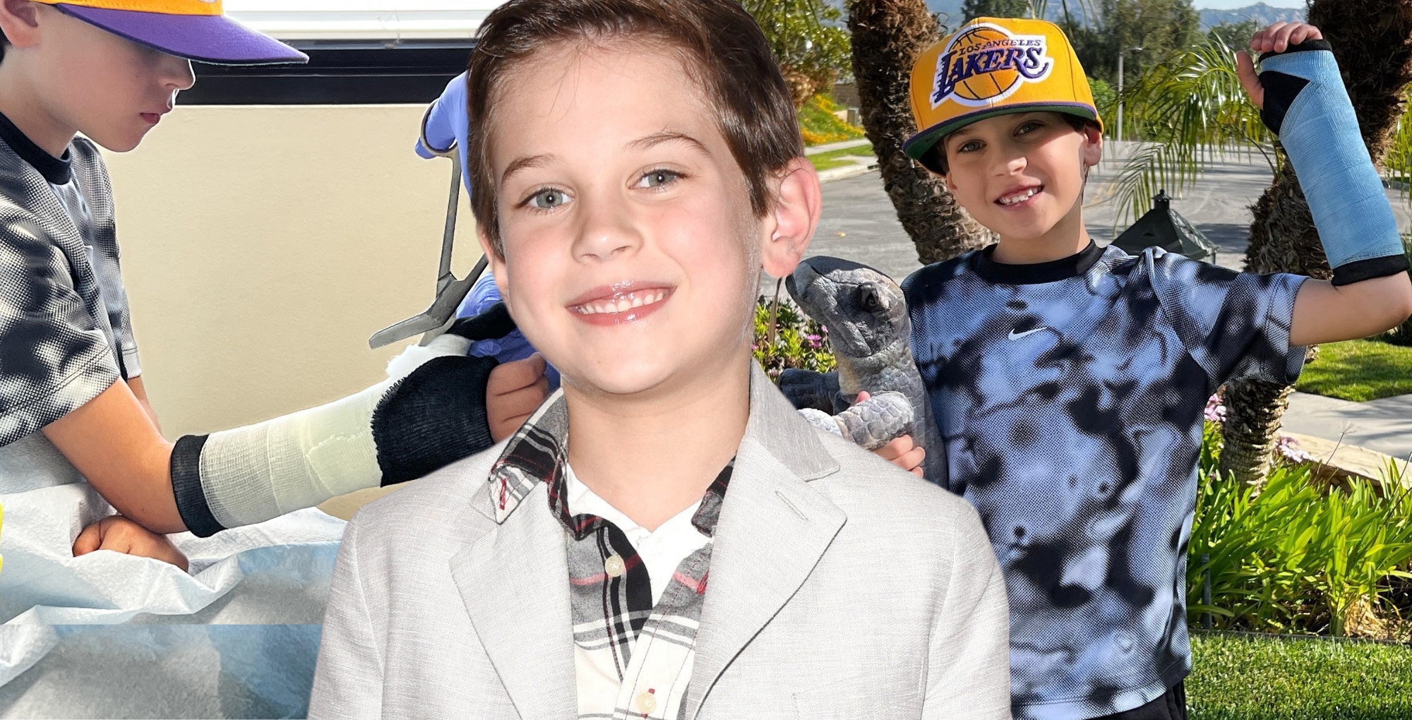 henry joseph samiri from the bold and the beautiful broke his arm.